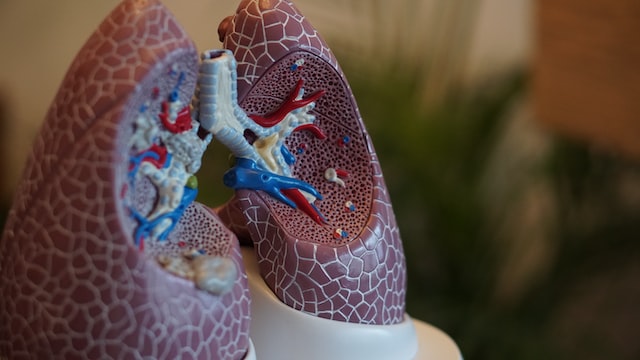 How To Reduce Your Aging Loved One's Risk of Lung Cancer